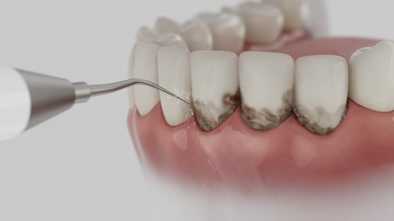 Trusted Teeth Cleaning And Checkup service in Harleigh, PA - Dentist Open Now